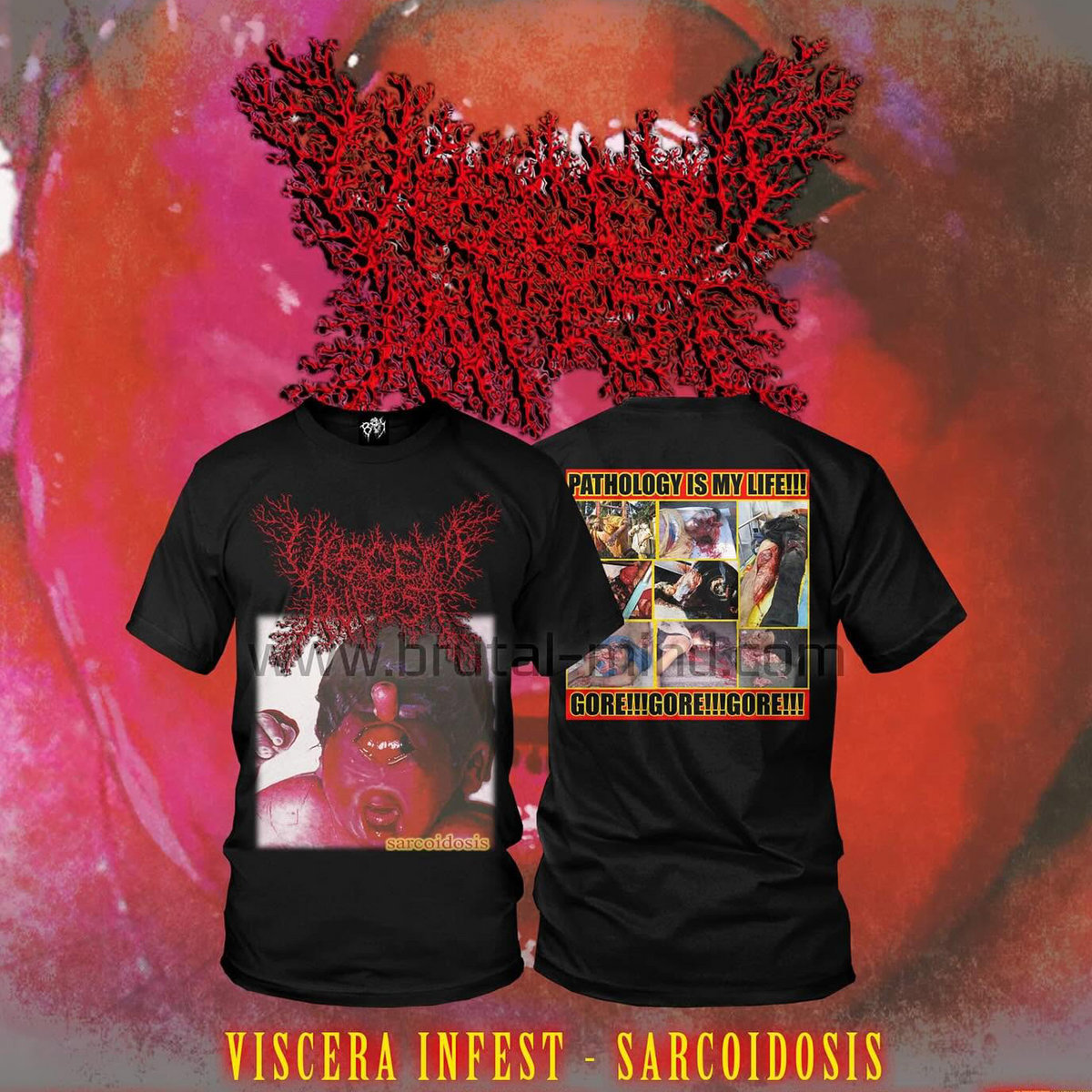 邦楽 VISCERA INFEST sarcoidosis TS – VISCERA INFEST – Sarcoidosis | Inherited Production