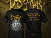 TS – VISCERA INFEST – Sarcoidosis | Inherited Production