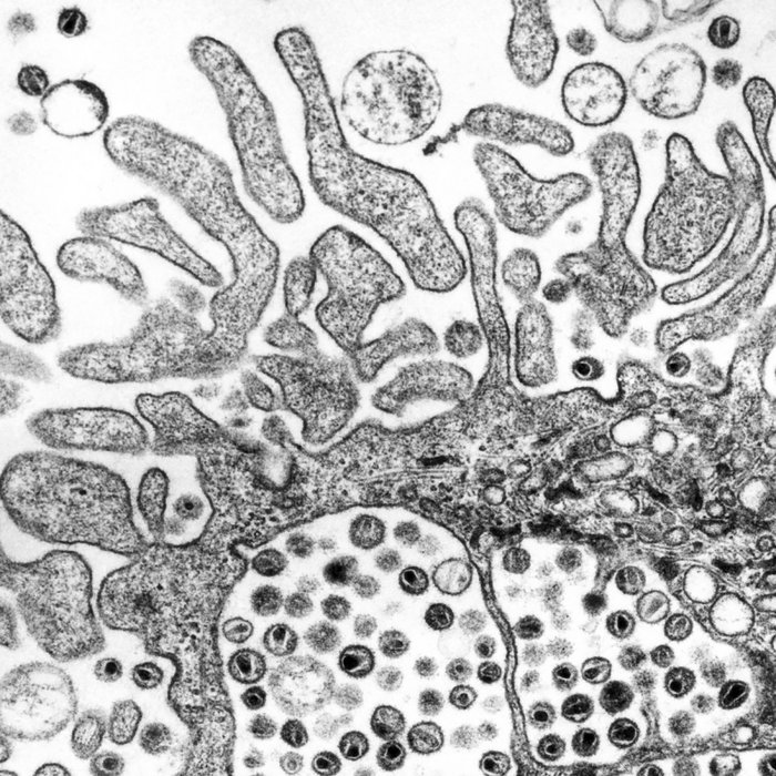 sessions #10-15 | GONOCOCCUS