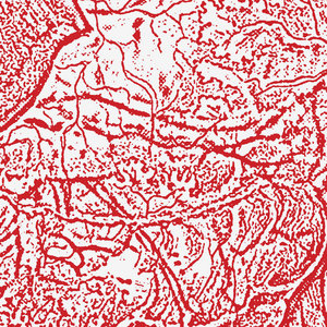 Materializing Defective Fascia cover