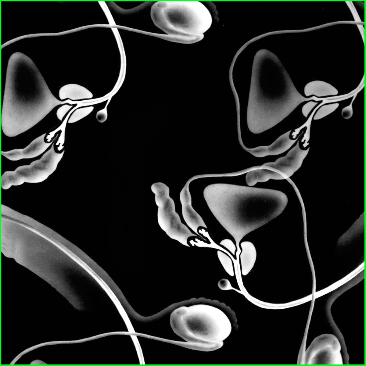 Medial forebrain bundle