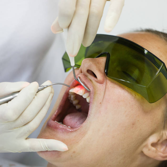 can you brush your gums too hard