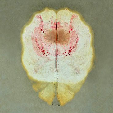 İçimize Doğru main photo