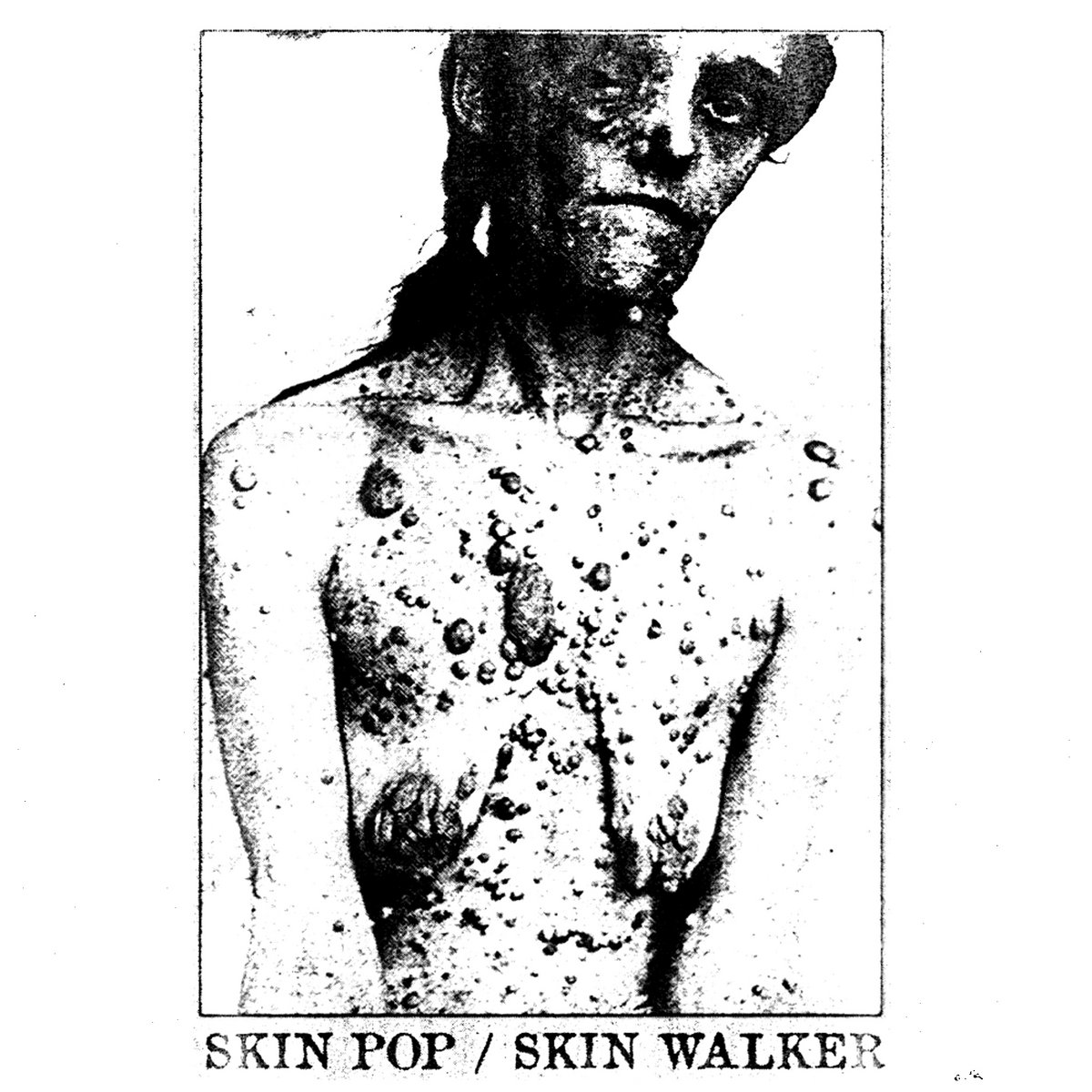 Skin Pop/Skin Walker