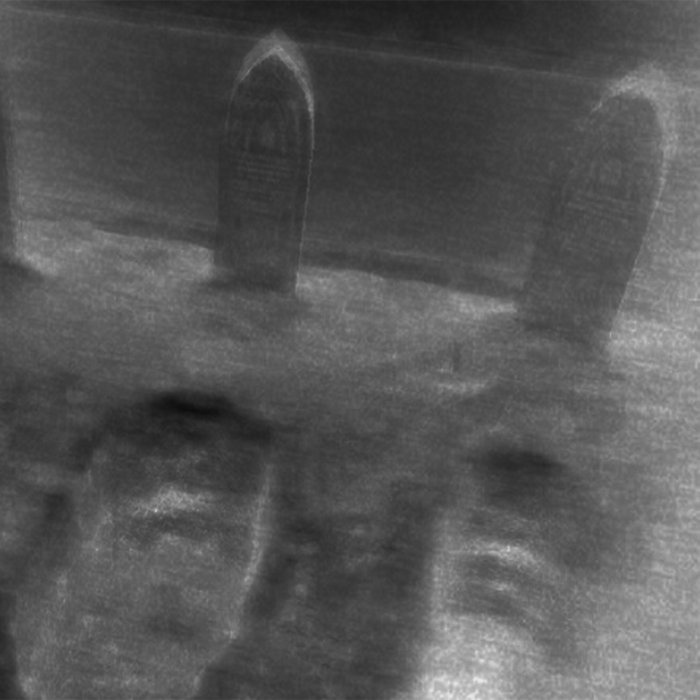 Mental Project Cheetoz