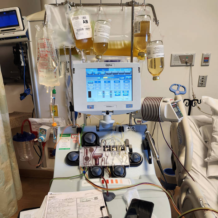 Plasmapheresis | RTOBEATS