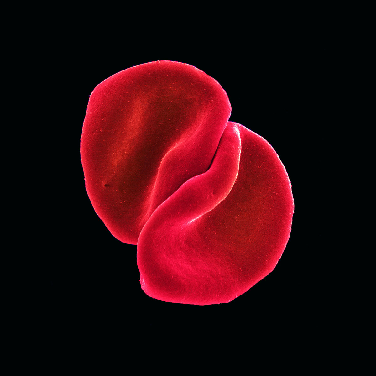 My Body Is A Cage | Peter Gabriel