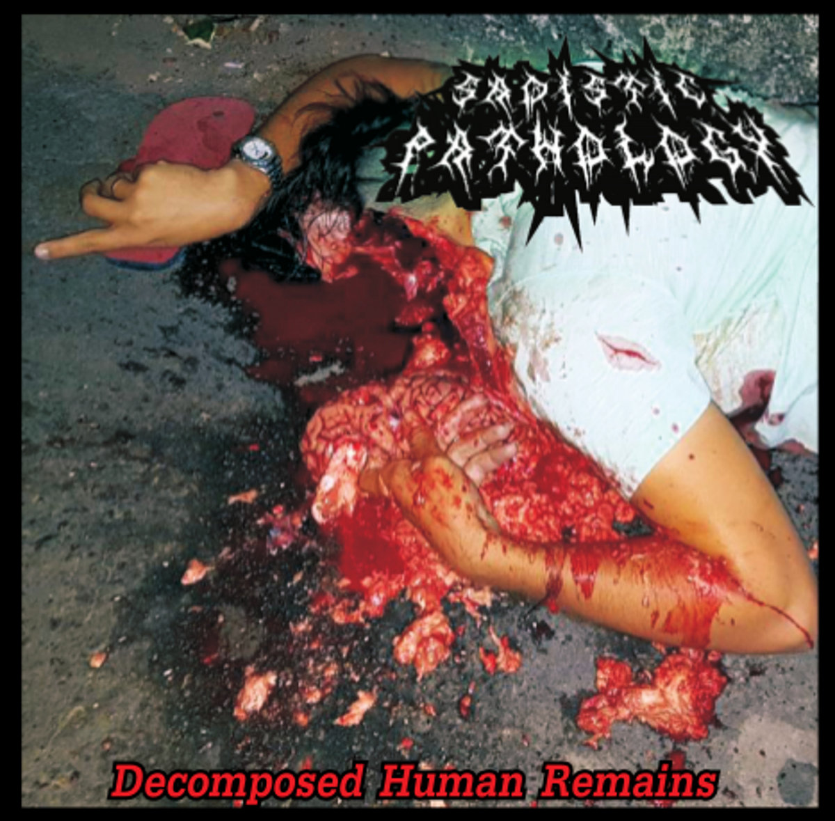 Head Crushed By a Truck | Sadistic Pathology | Old Grindered Days Records