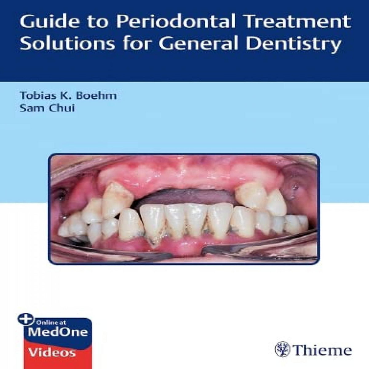 Get PDF EBOOK EPUB KINDLE Guide to Periodontal Treatment Solutions for