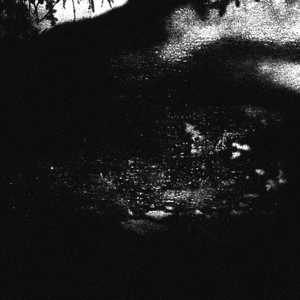 Overtoun Bridge First Field Dressing