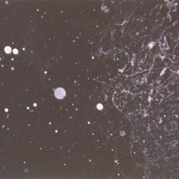 King's County Unveiled: A Glimpse into the Shadows of Death Statistics Revealed in Coroner's Records