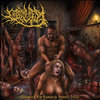 Aspiration Pneumonia Urolagnia Erotica