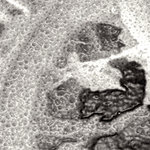 Fragment 3