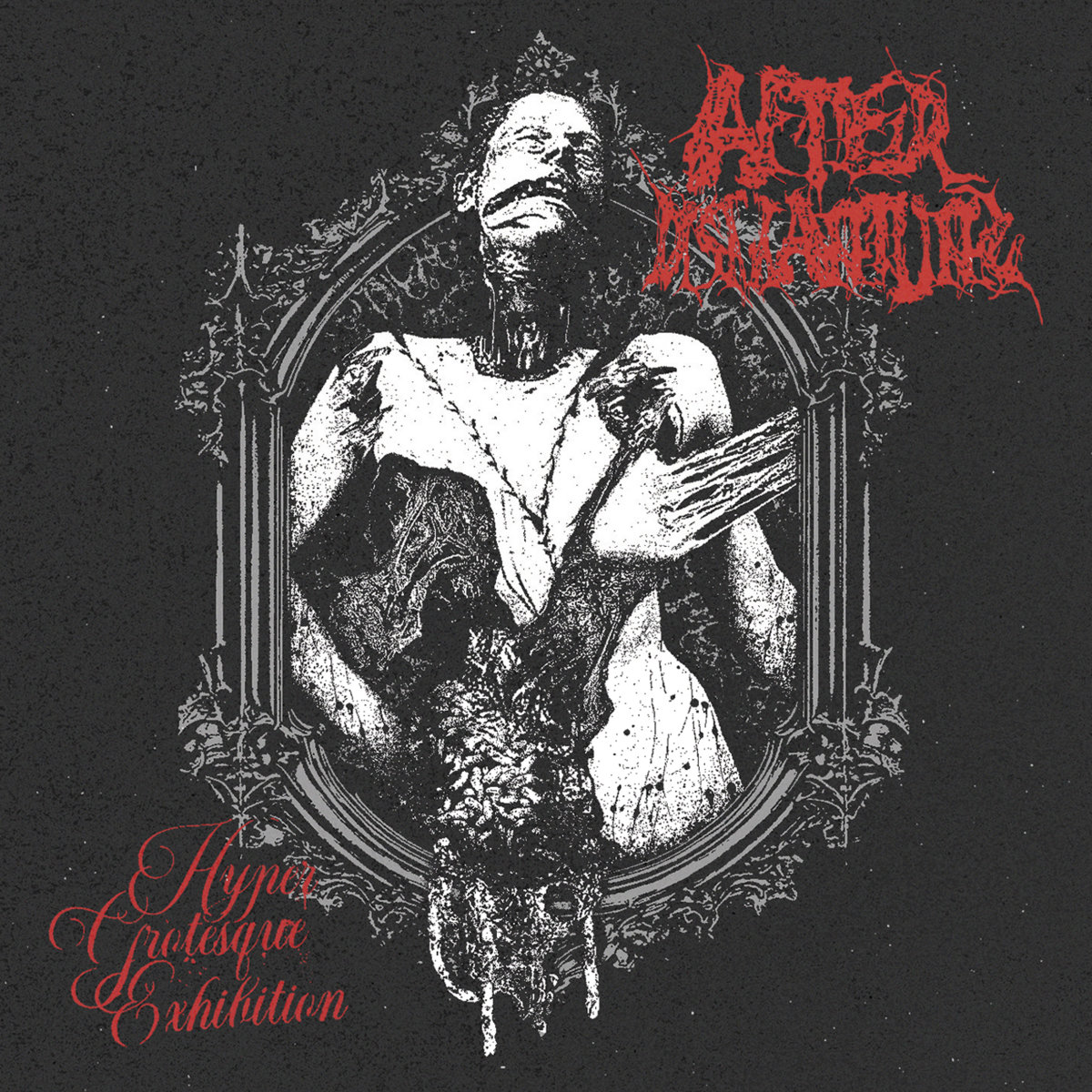Cadaveric Malignancy | SEPTIC AUTOPSY | Bizarre Leprous