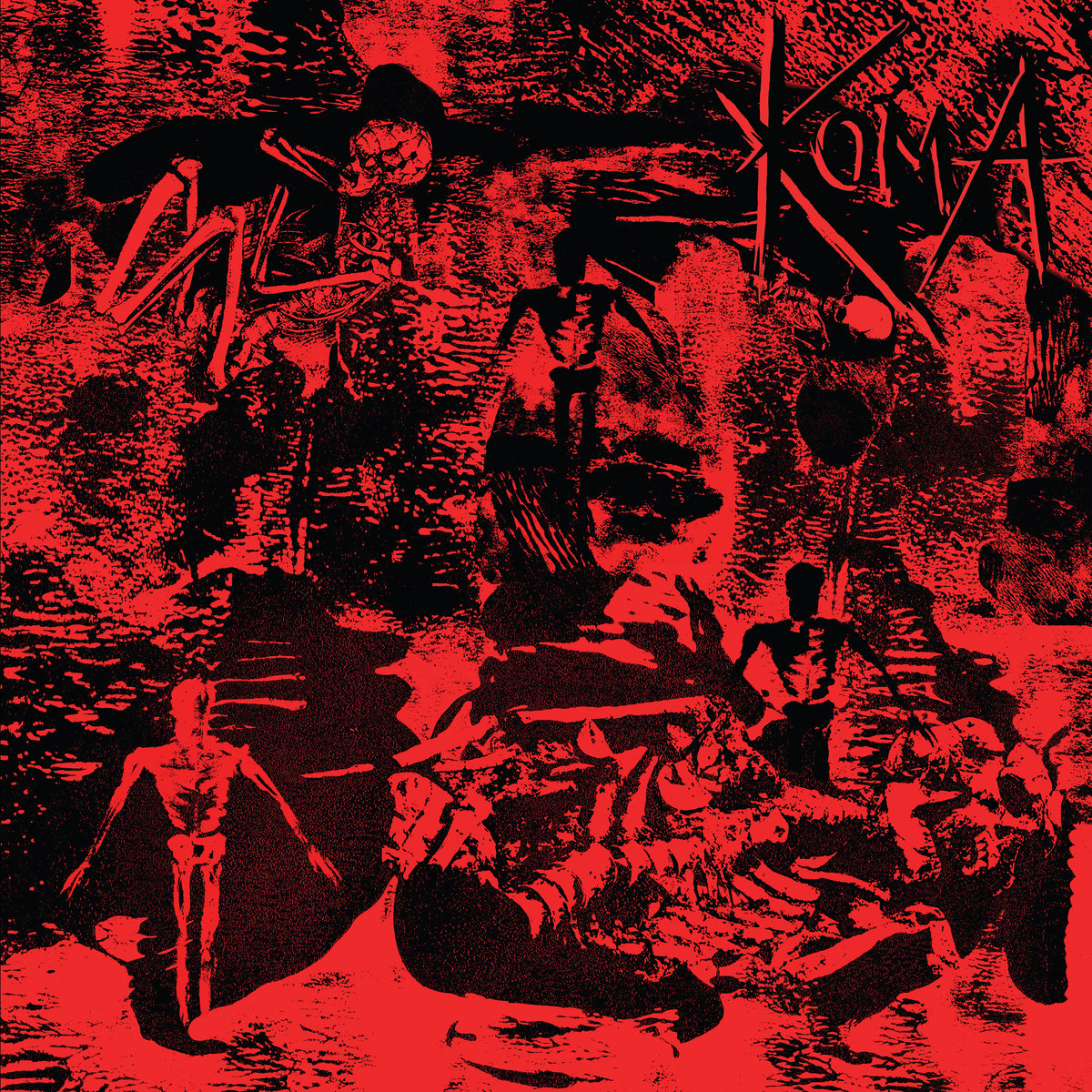 Internment Failure | Koma | LA VIDA ES UN MUS DISCOS