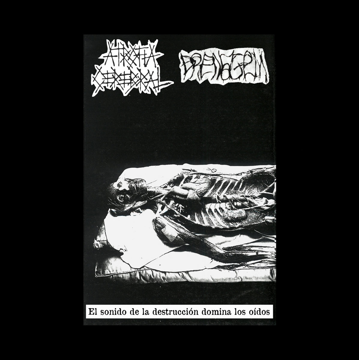 Atrofia Cerebral Atrofia Cerebral & Drenagem Nekrogoat Heresy