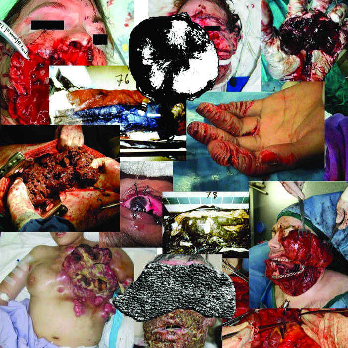 SPLIT WITH SEPTIC ABRASIONS Horse Cock Bowel Obstruction