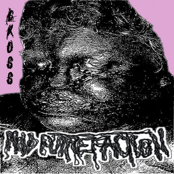 Music | Bowel Infection Records