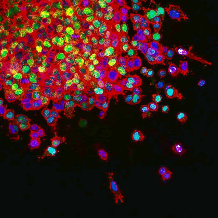 Cells The Teardrop Phase