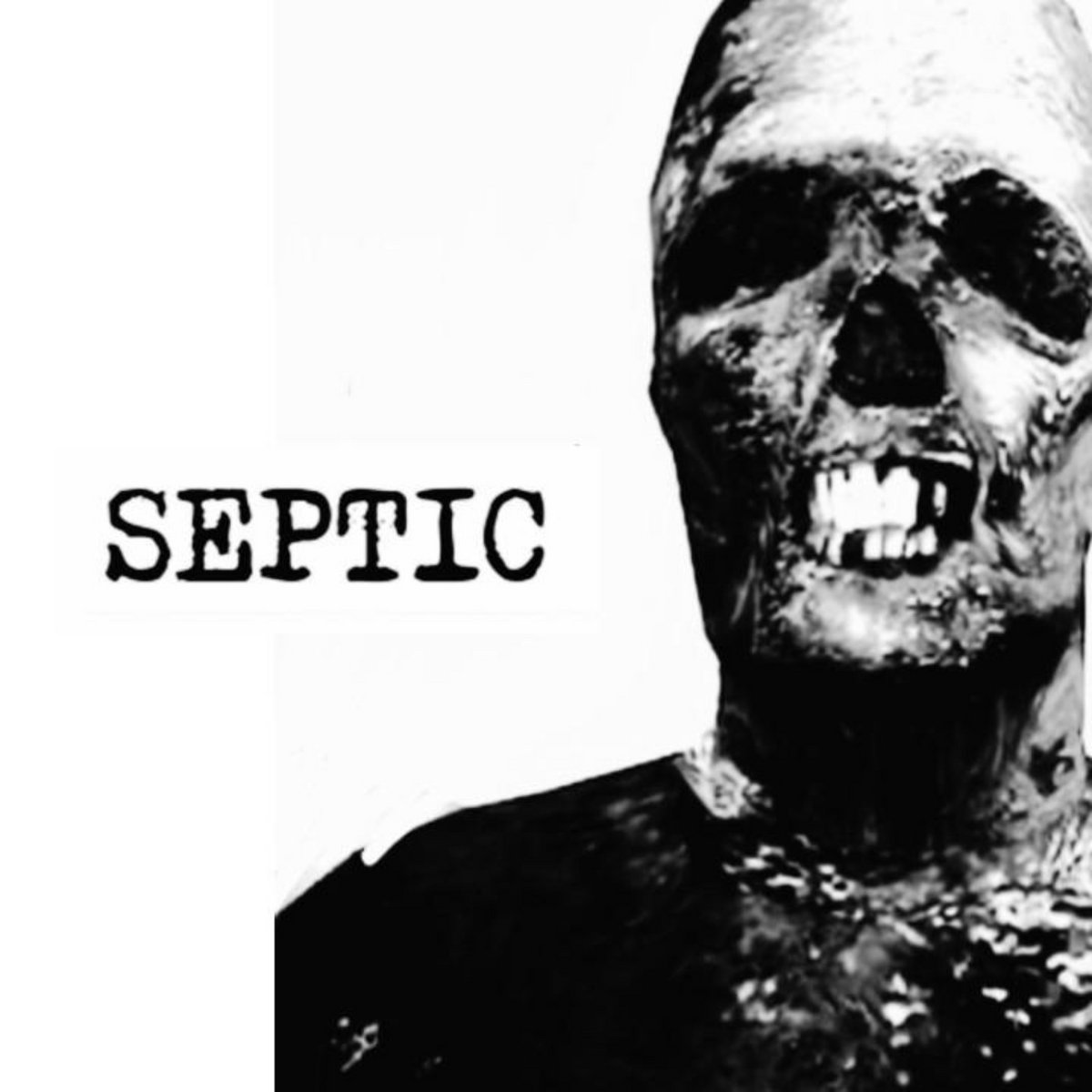 SEPTIC