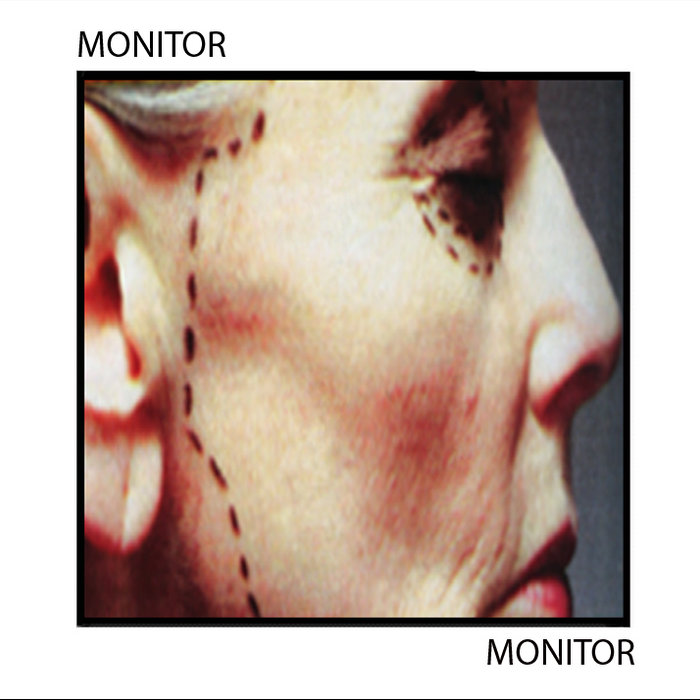 Monitor (2007) | Monitor