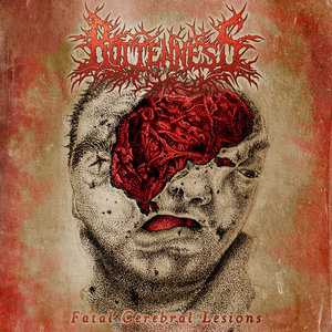 Fatal Cerebral Lesions [Demo] cover