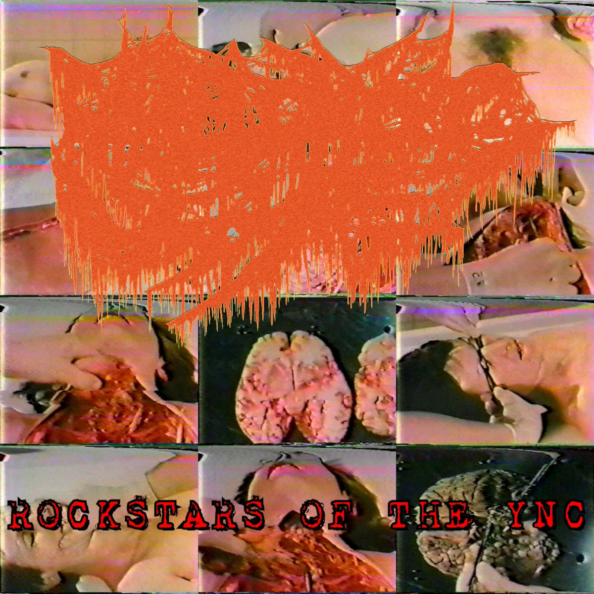 Rockstars of the YNC | Rhabdomyolic Seizure