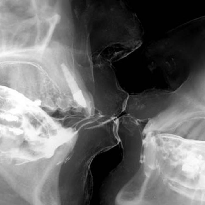 ������� ������ ����� - 4