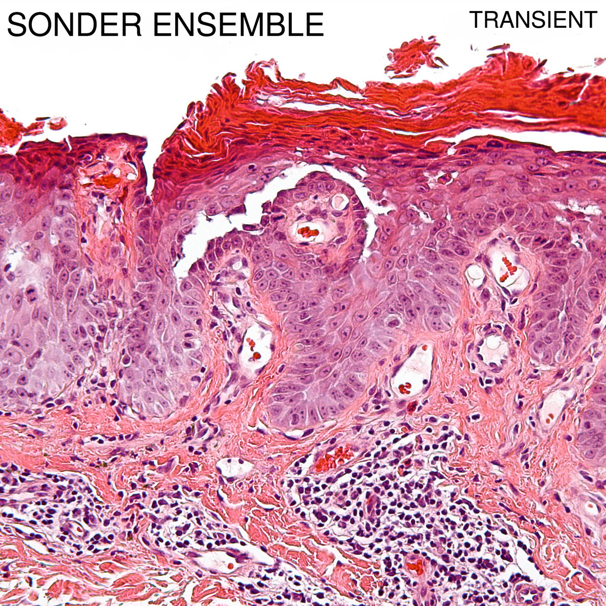 Transient EP Sonder Ensemble