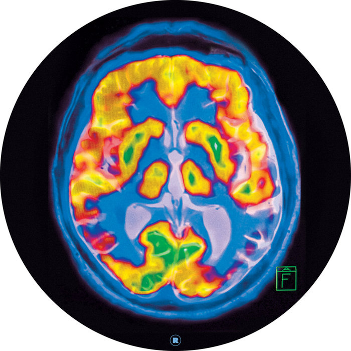 Brainscan | Frankey & Sandrino
