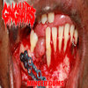 Gum Rot