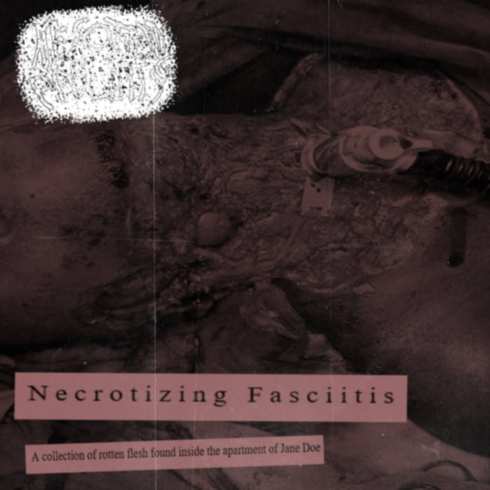 a collection of rotten flesh found inside the apartment of Jane Doe