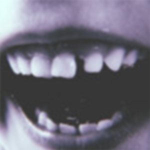 Loose Tooth (demo) cover
