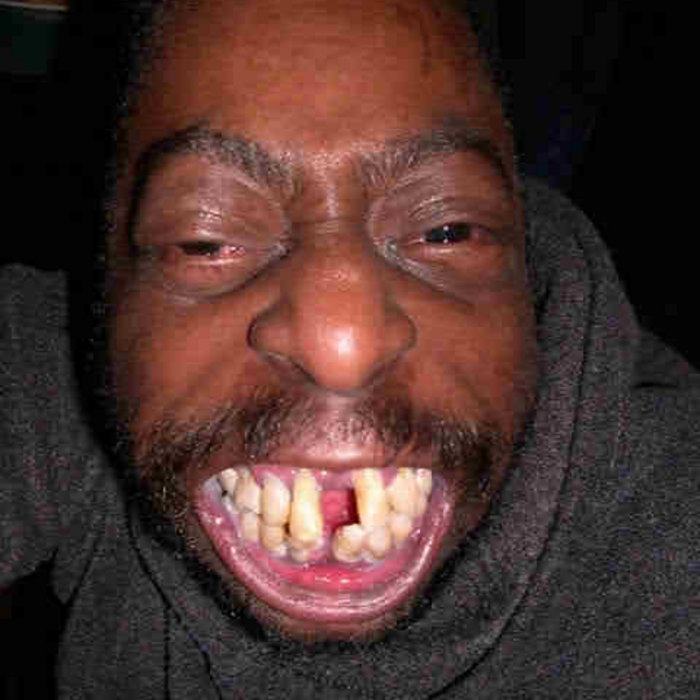 Nude ugly fanny free pics