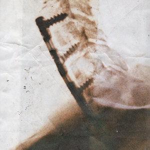 evntyd — Spleen / Ever Left
