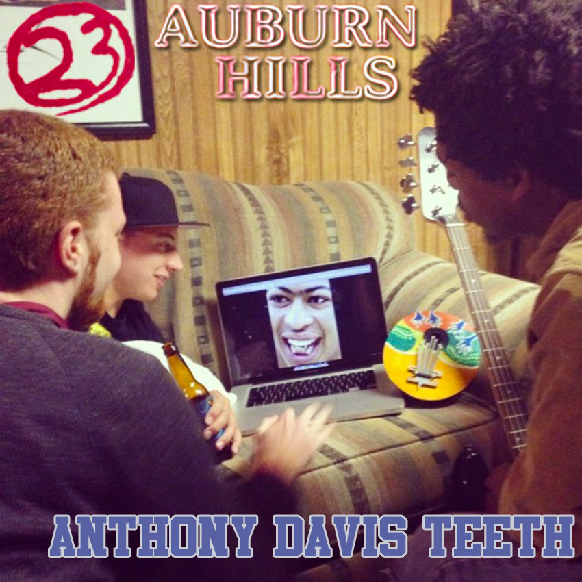 Anthony Davis Teeth Auburn Hills