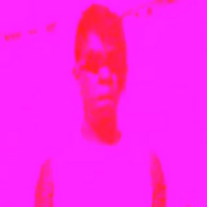Adam: The Shock Deformity and Amputee Documentary cover