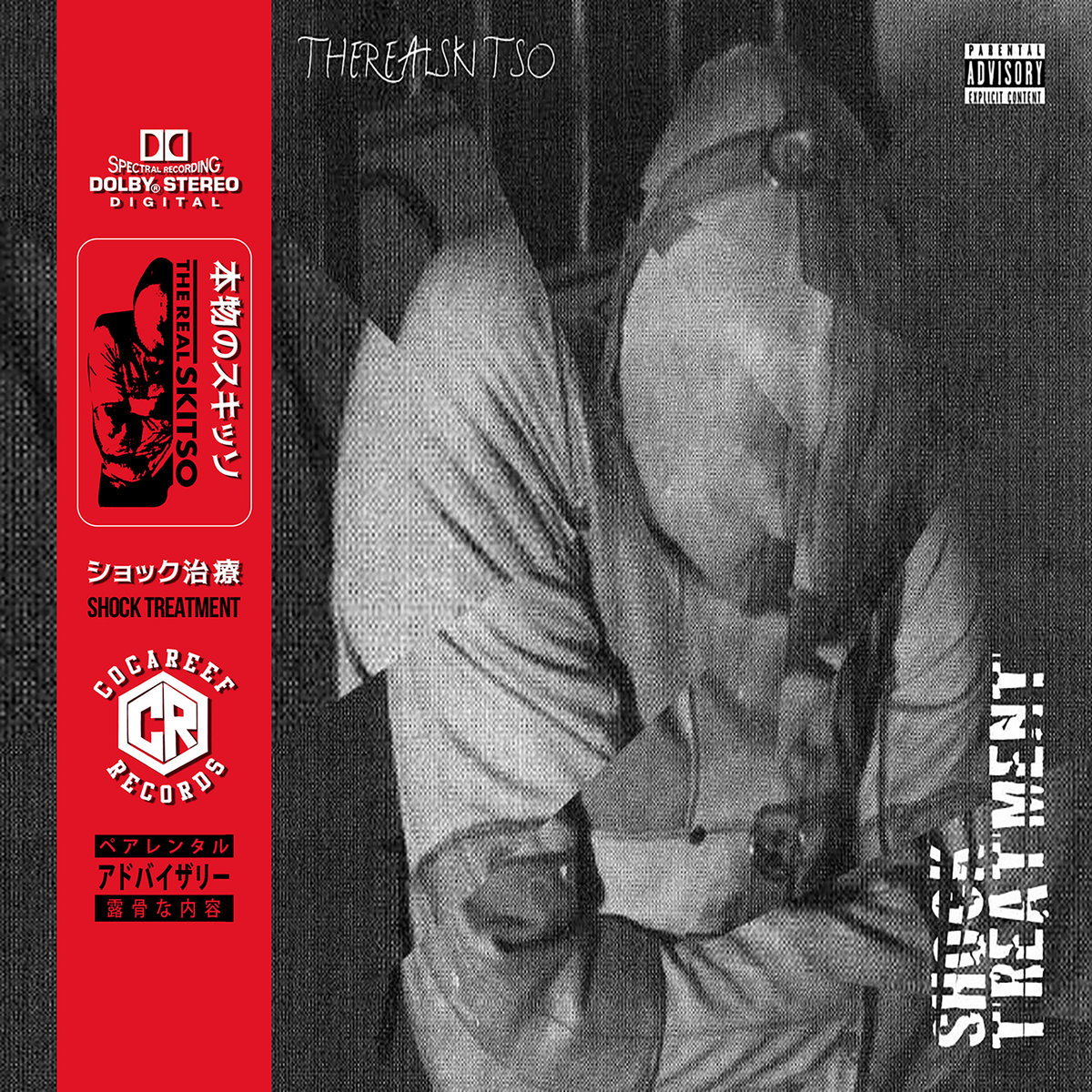 Shock Treatment | TheRealSkitso | Cocareef