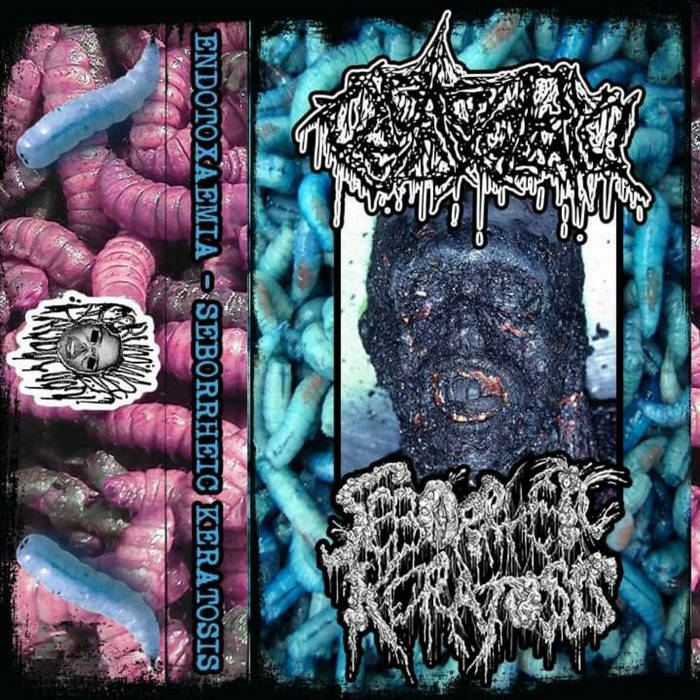 split w. Seborrheic Keratosis | Endotoxaemia