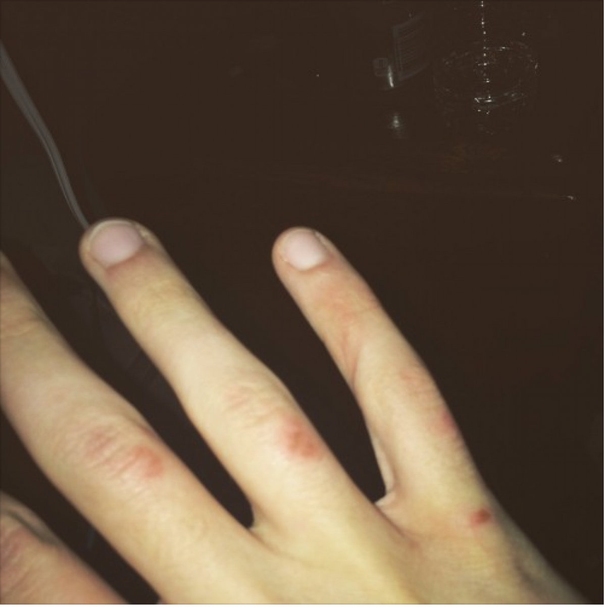 CRY BABY | Bloody Knuckles