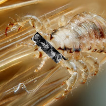 Radiohead Lice Infestation cover art