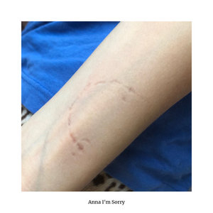 Anna I'm Sorry cover