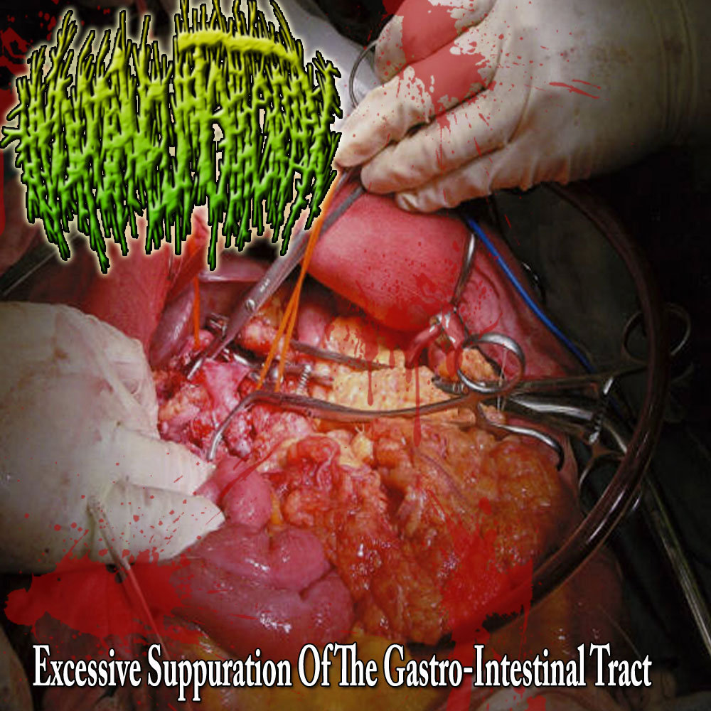 excessive suppuration of the gastro intestinal tract torn flesh