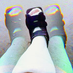 Broken Foot