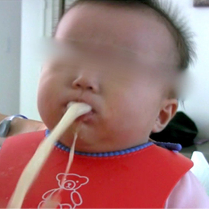 рвота фонтаном у грудничка