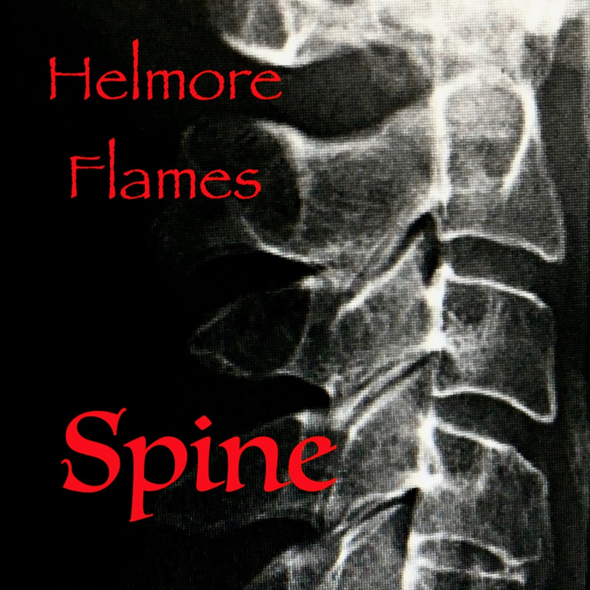 Spine