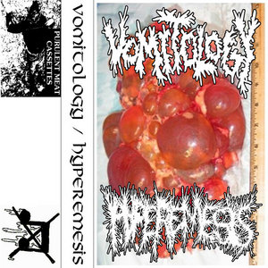 SPLIT TAPE WITH HYPEREMESIS cover