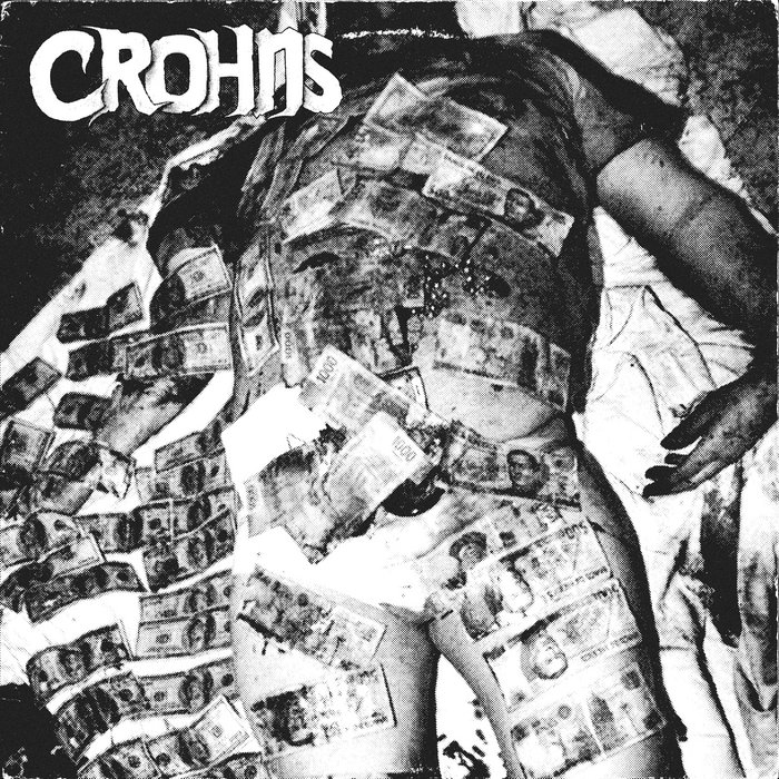 DISEASE EP | CROHNS