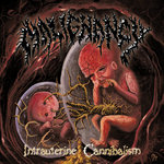 Intrauterine Cannibalism