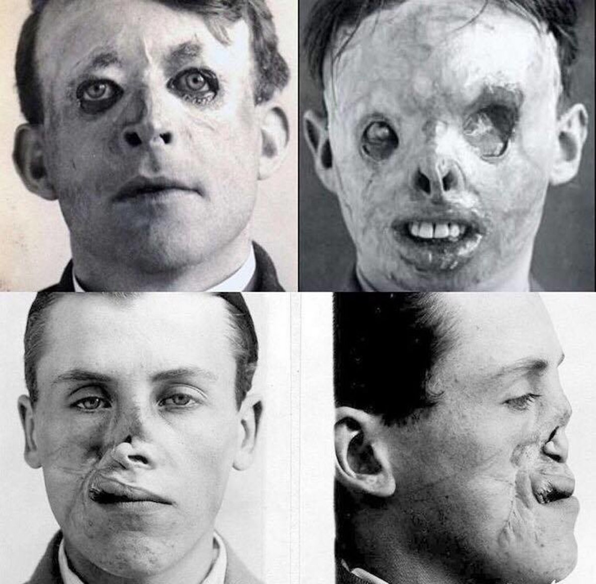 Demonstration 2017 by Bandit